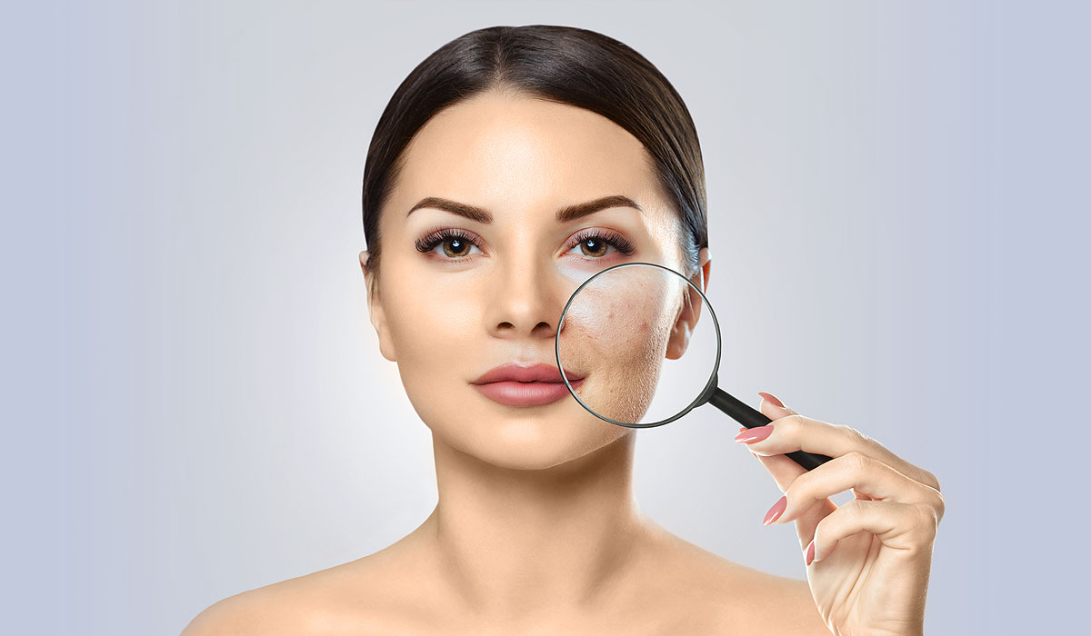 hautarztpraxis keller akne