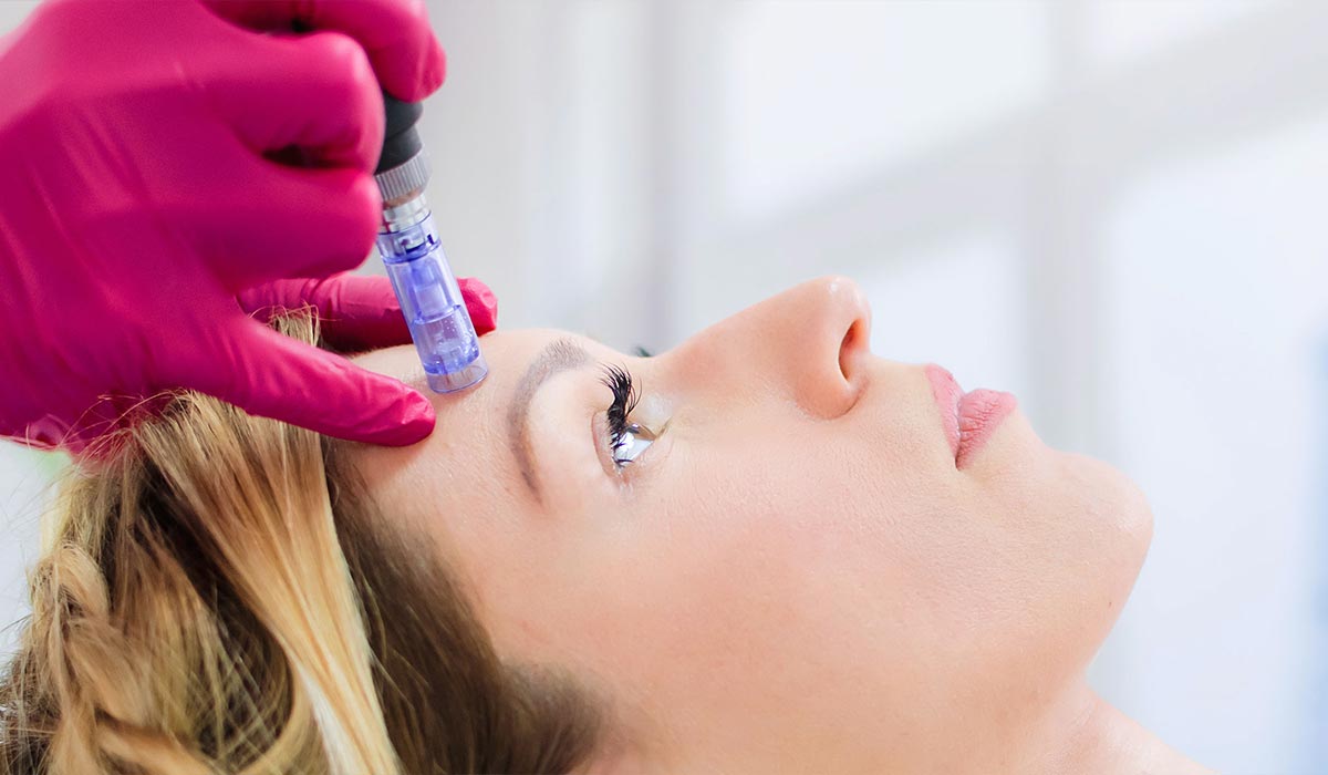 hautarztpraxis keller medical needling